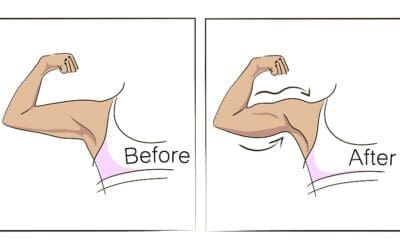 Ditch The Bat Wings In Just 15 Minutes A Day